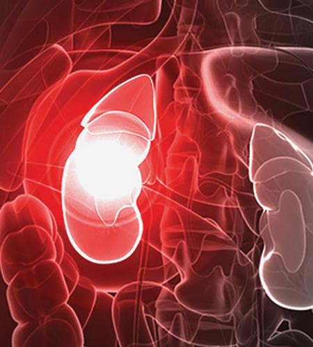 Rapidly Progressive Renal Failure Treatment in Vijayawada